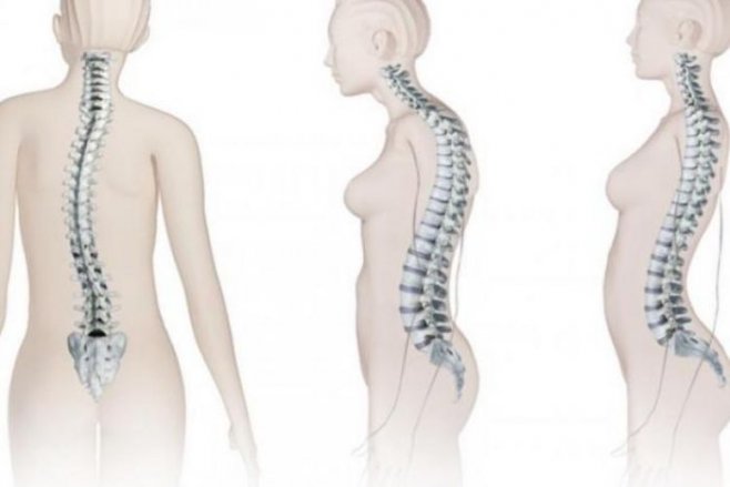 Упражнения для лечения боли в спине